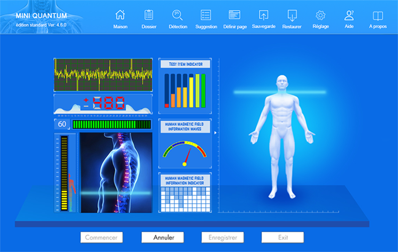 Informe cardiovascular del analizador cuántico mostrando gráficos de salud cardíaca