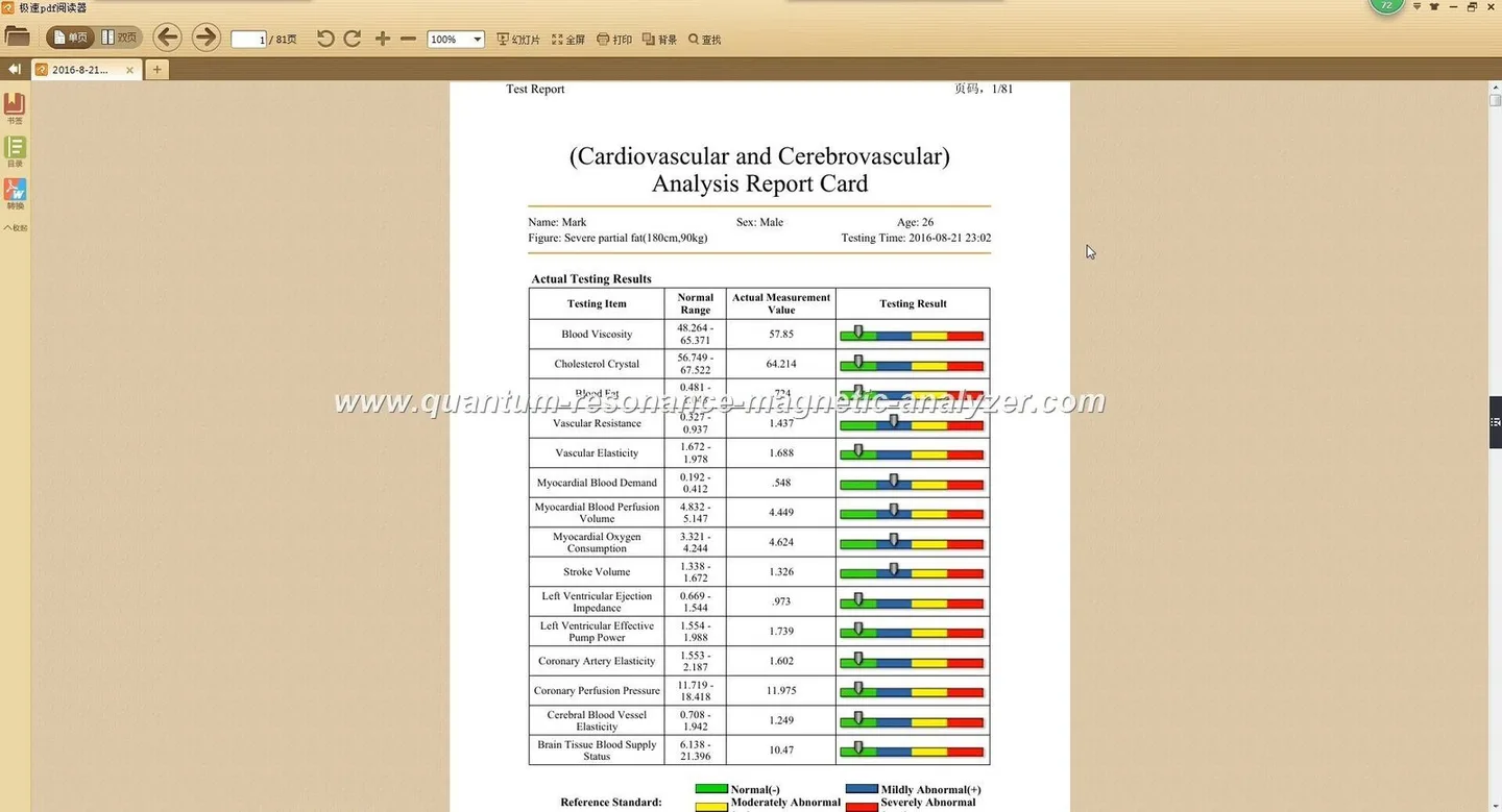 ¿Qué significa “Sin categorizar” en la ficha de un Bioescaner cuántico y qué debe verificar un profesional de terapias complementarias en Colombia? — quantum resonance magnetic analyzer software Reports (6).JPG