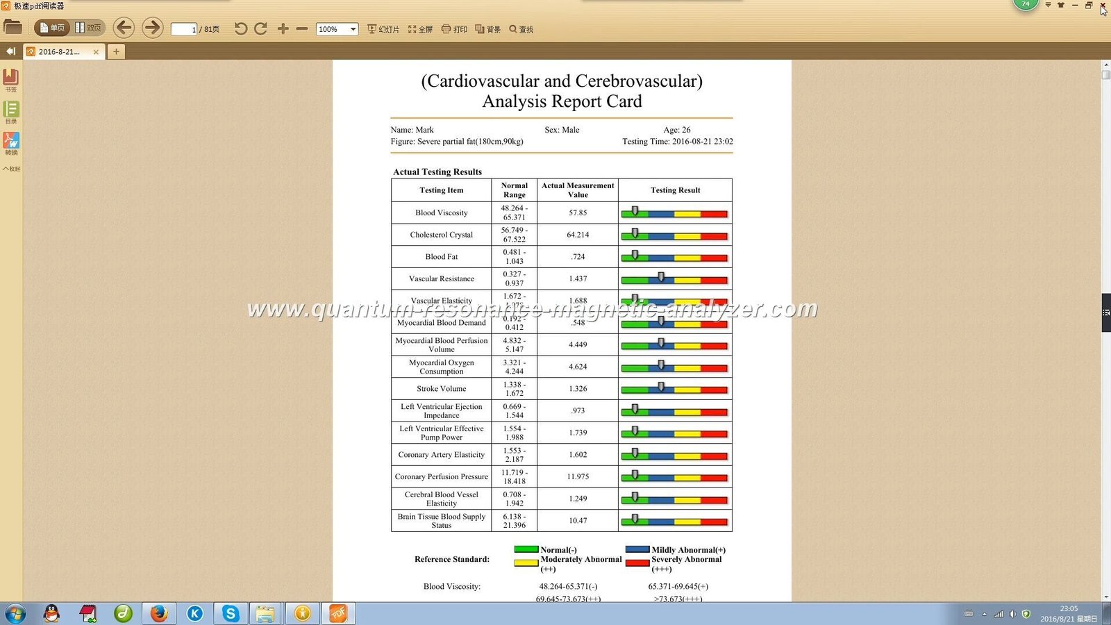 Reportes personalizados útiles para tiendas naturistas: nutrición, estética y terapias complementarias — quantum resonance magnetic analyzer software Reports (2).JPG