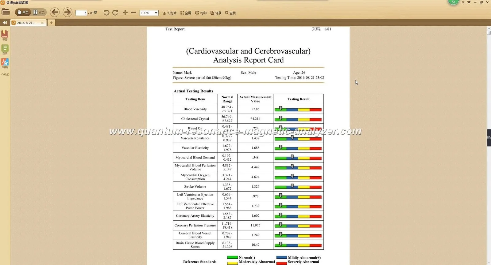 Cómo afectan fiebres e inflamaciones agudas a las lecturas del analizador cuántico MK-001 — quantum resonance magnetic analyzer software Reports (6).JPG